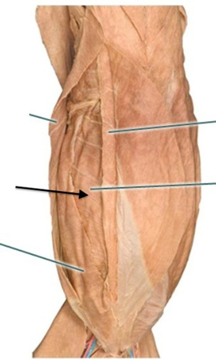 <p>what muscle is being indicated by the arrow?</p>