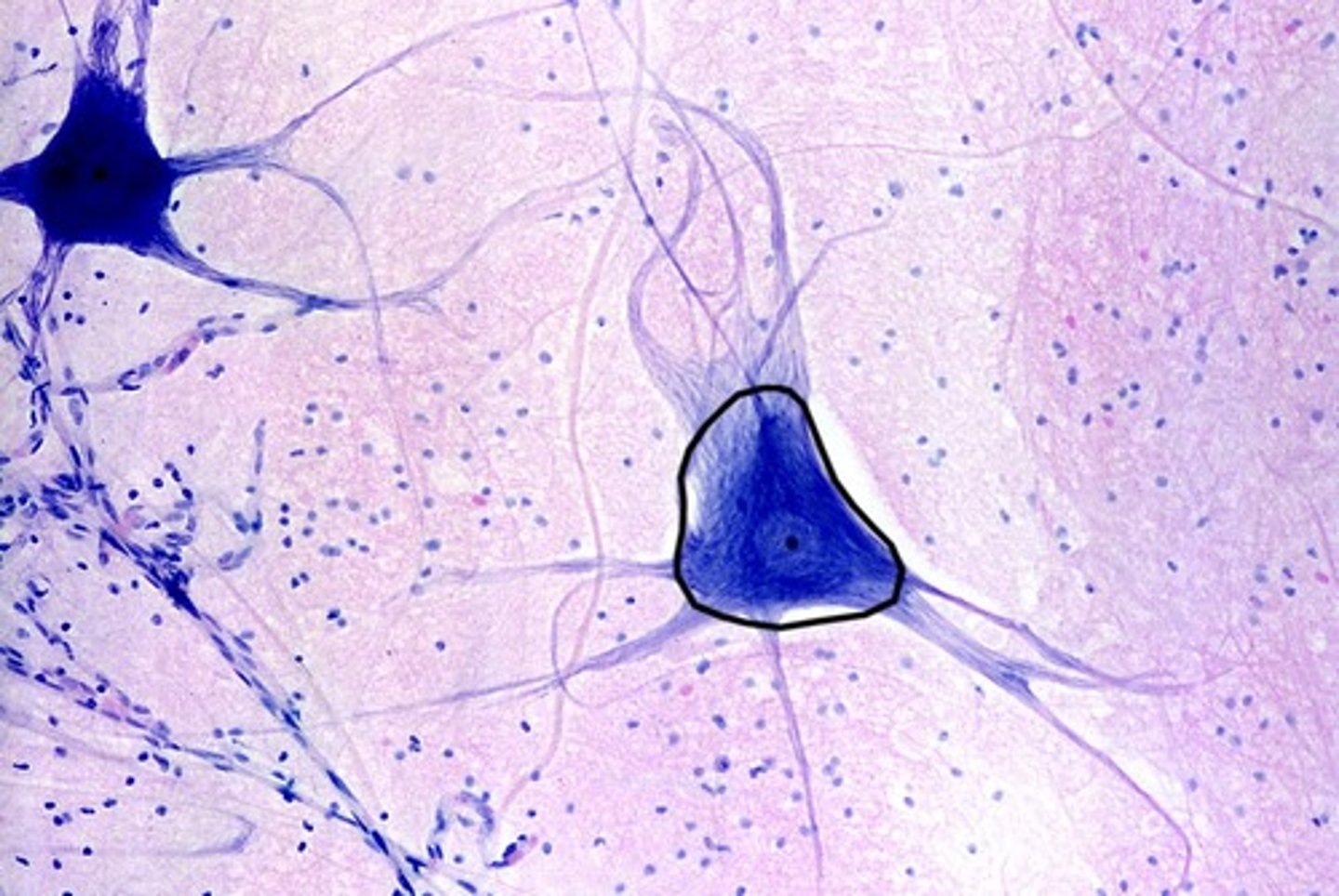<p>cell body of a neuron</p>