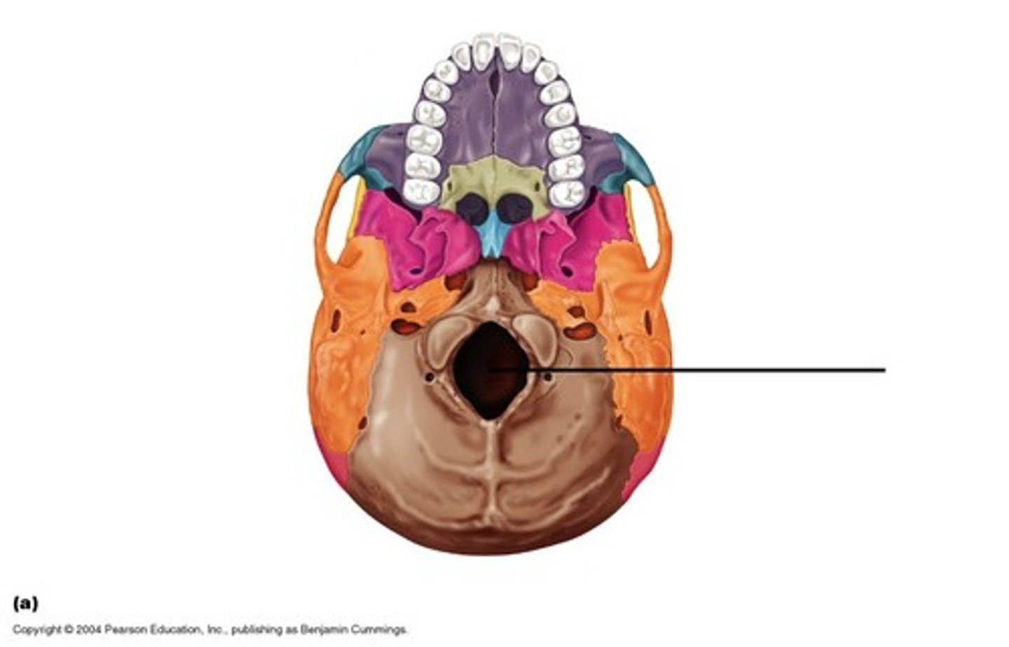 <p>anterolateral to occipital and posterolateral to sphenoid (orange)</p>