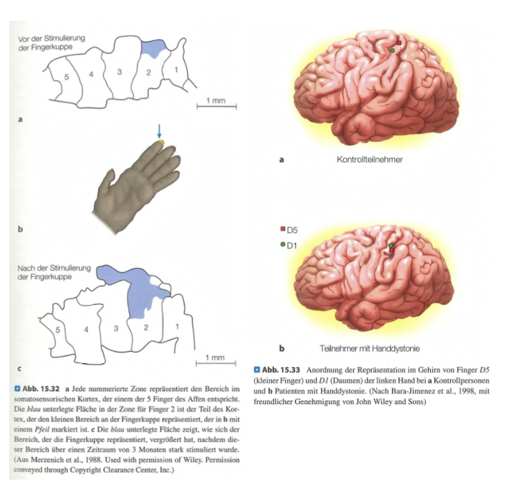 <p class=""><strong>Kurzfassung:</strong><br><strong>Kortikale Plastizität</strong> beschreibt, wie sich <strong>somatosensorische Karten im Gehirn</strong> durch <strong>Nutzung</strong>, <strong>Verletzung</strong> oder <strong>Training</strong> verändern. Repräsentationen sind <strong>dynamisch</strong> – häufiger Gebrauch vergrößert, Inaktivität verkleinert sie. Plastizität ermöglicht <strong>Anpassung</strong> an neue Anforderungen.</p><div data-type="horizontalRule"><hr></div><p class=""><strong>Langfassung:</strong></p><ul><li><p class=""><strong>Veränderung durch Nutzung:</strong></p><ul><li><p class=""><strong>Training oder häufige Nutzung</strong> (z. B. Musiker, die ein Saiteninstrument spielen) vergrößert die <strong>kortikale Repräsentation</strong> der genutzten Finger.</p></li><li><p class=""><strong>Jenkins & Merzenich (1987):</strong> Stimulation eines Affenfingers über Monate → <strong>größeres Areal</strong> im somatosensorischen Kortex.</p></li></ul></li></ul><p class=""></p><ul><li><p class=""><strong>Veränderung durch Verletzung oder Inaktivität:</strong></p><ul><li><p class="">Bei <strong>Nichtgebrauch</strong> (z. B. nach Fingerverlust) übernehmen <strong>benachbarte Körperregionen</strong> die zuvor genutzte kortikale Fläche.</p></li><li><p class="">Beispiel: Nach <strong>Amputation</strong> kann das Areal für den Finger durch <strong>Gesicht oder benachbarte Finger</strong> ersetzt werden.</p></li></ul></li></ul><p class=""></p><ul><li><p class=""><strong>Handdystonie (z. B. bei Profimusikern):</strong></p><ul><li><p class="">Intensive, <strong>wiederholte Nutzung</strong> kann zu <strong>abnormaler kortikaler Überlappung</strong> führen.</p></li><li><p class="">Folge: <strong>Verlust differenzierter Steuerung</strong>, da Fingerareale <strong>zusammenrücken</strong> und nicht mehr getrennt arbeiten.</p></li></ul></li></ul><p class=""></p><ul><li><p class=""><strong>Allgemeines Prinzip der Plastizität:</strong></p><ul><li><p class="">Das Gehirn ist <strong>formbar</strong> und reagiert auf <strong>Erfahrung und Umwelt</strong>.</p></li><li><p class="">Beispiele:</p><ul><li><p class=""><strong>Echoortung</strong> bei Blinden.</p></li><li><p class=""><strong>Sprachverarbeitung</strong> bei früher Zweitspracherwerb.</p></li><li><p class=""><strong>Musikalisches Training</strong> verändert Hörareale.</p></li></ul></li><li><p class="">Plastizität ist nicht nur im somatosensorischen, sondern auch im <strong>visuellen und auditiven System</strong> nachgewiesen.</p></li></ul></li></ul><p class=""></p><ul><li><p class=""><strong>Fazit:</strong></p><ul><li><p class="">Plastizität ist <strong>grundlegend für Lernen, Anpassung und Erholung</strong>.</p></li><li><p class="">Sie zeigt, dass das Gehirn <strong>nicht starr</strong>, sondern <strong>kontinuierlich veränderbar</strong> ist – ein zentrales Merkmal menschlicher Wahrnehmung und Entwicklung.</p></li></ul></li></ul><p></p>