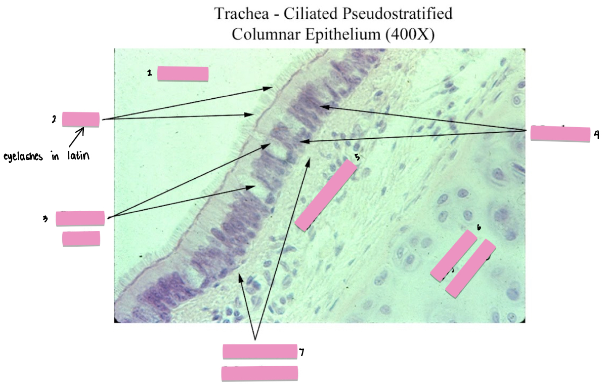 <p>(7) Ciliated Pseudostratified Columnar Epithelium tissue cellular characteristics</p>
