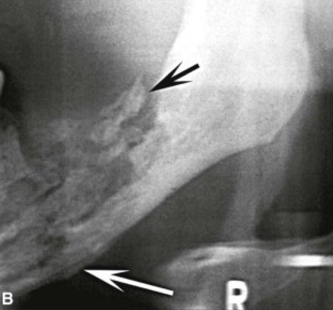 <p>white and black arrow</p>