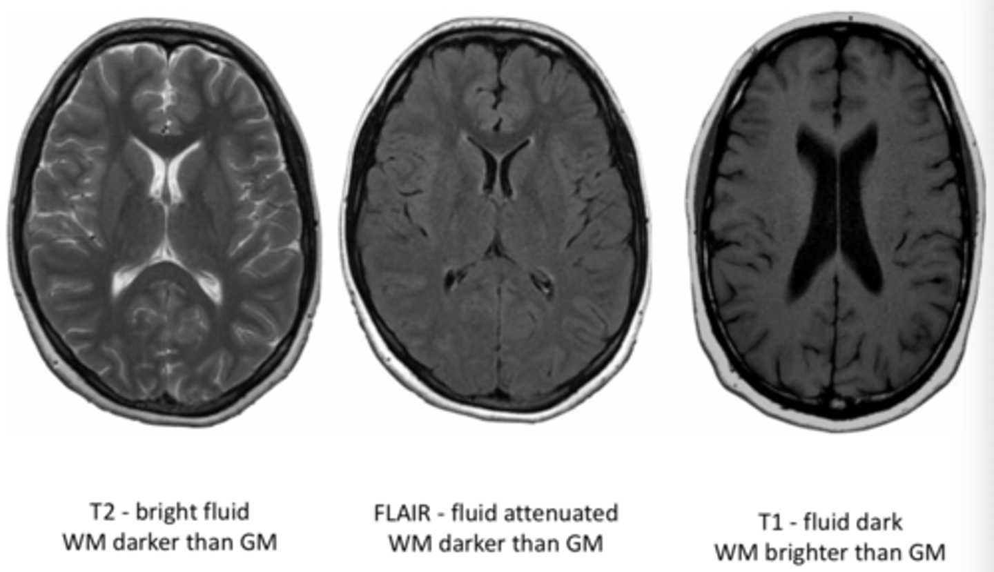 <p>Similar to T2, but CSF is dark</p>