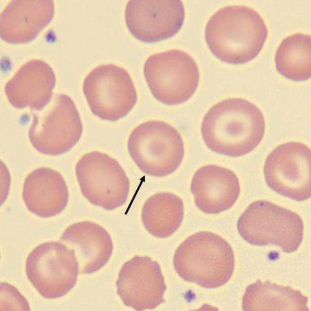 <p>What is the shape of this erythrocyte?</p>