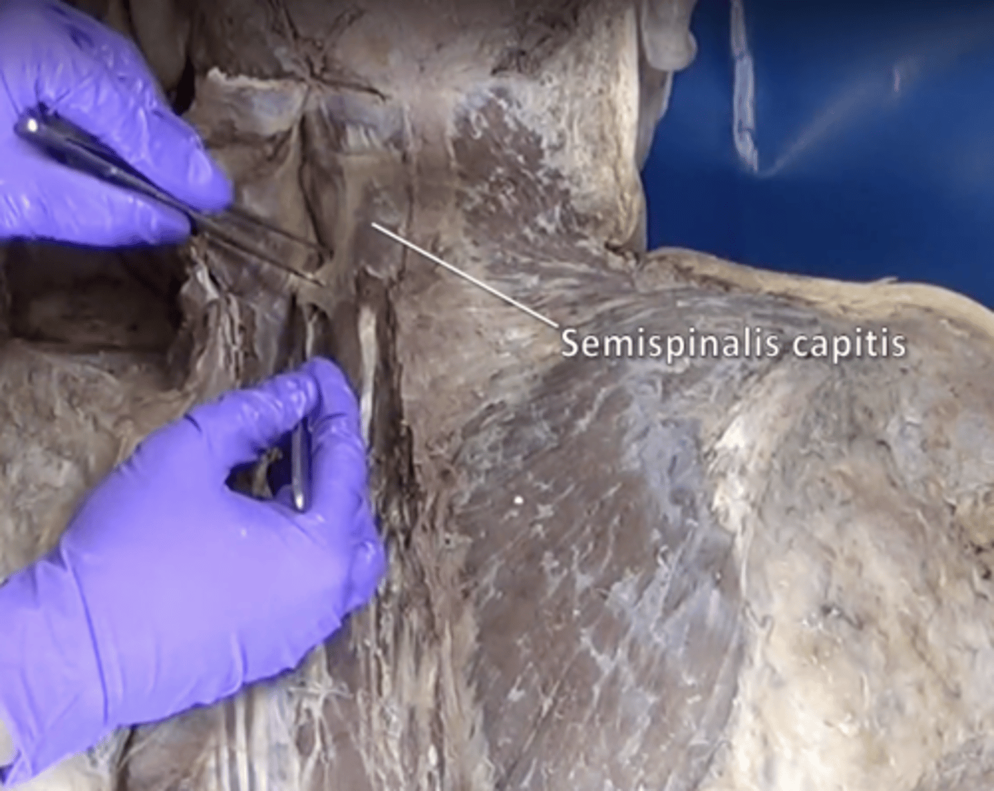 <p>extends and rotates head and vertebral column. Lies deep to splenius capitis muscle with vertical fibers</p>