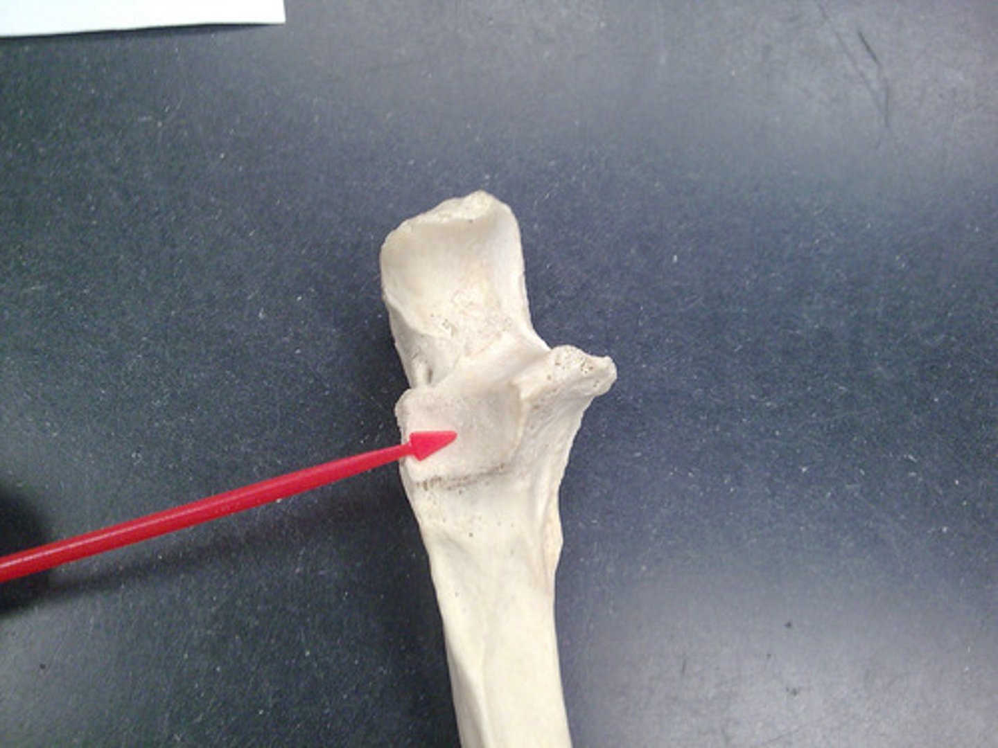 <p>feature</p><p>on anterior side</p>