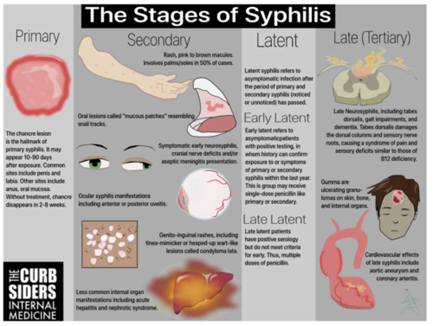 <p>summary of the stages of syphilis:</p>
