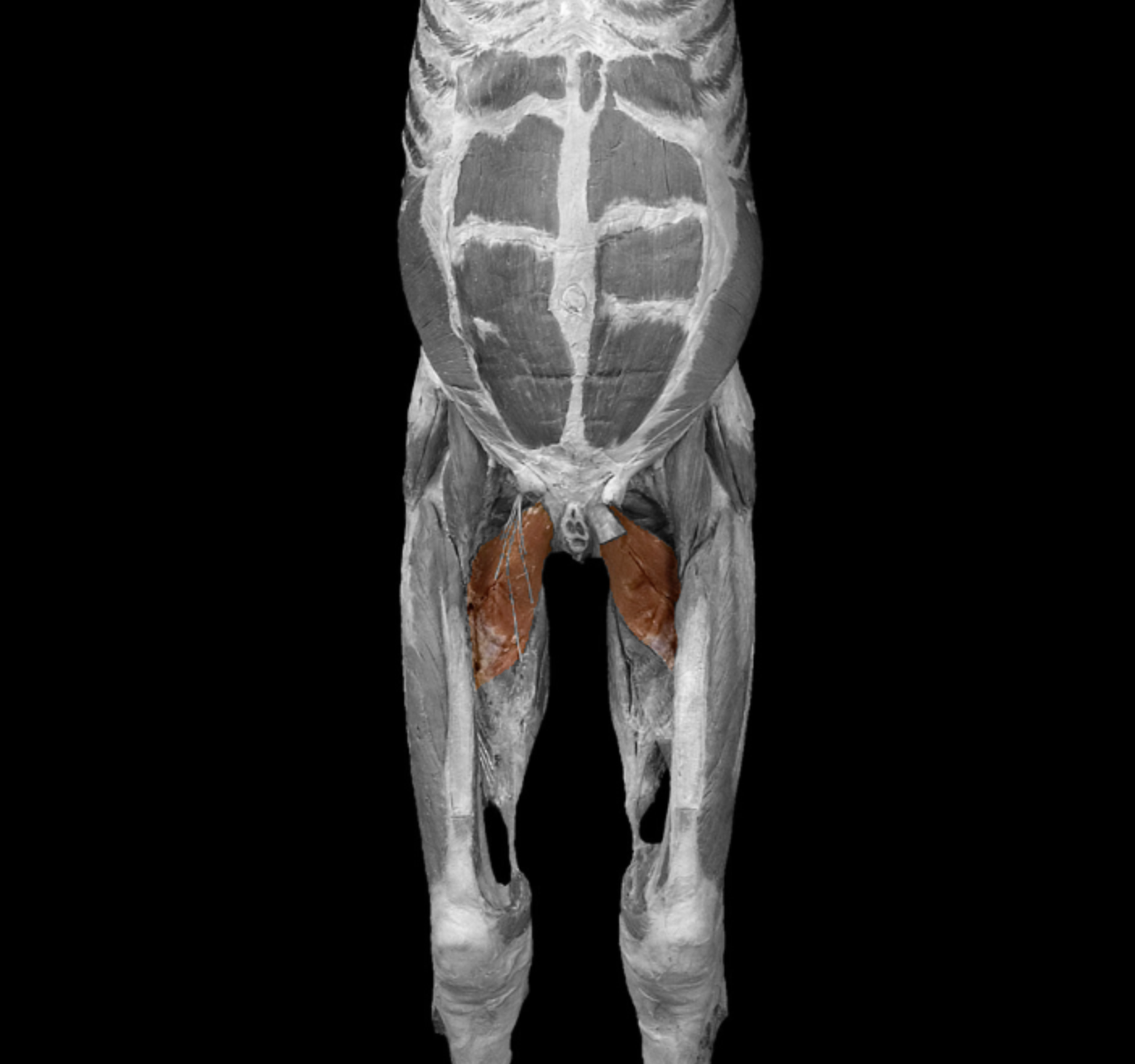 <p>origin: inferior armies of pubis </p><p></p><p>insertion: upper half of linea aspera of femur </p><p></p><p>action: adduct and flex thigh at hip, rotate thigh </p><p></p><p>innervation: obturator nerve </p>