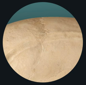 <p>completely immovable</p><p>e.g. suture of the skull</p><p>manubriosternal joint</p>