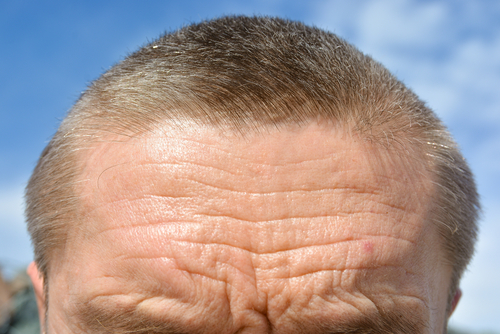 <p>Furrow</p><p>(Also called wrinkle or sulcus. You’re going to see the word SULCI appear a lot) </p>