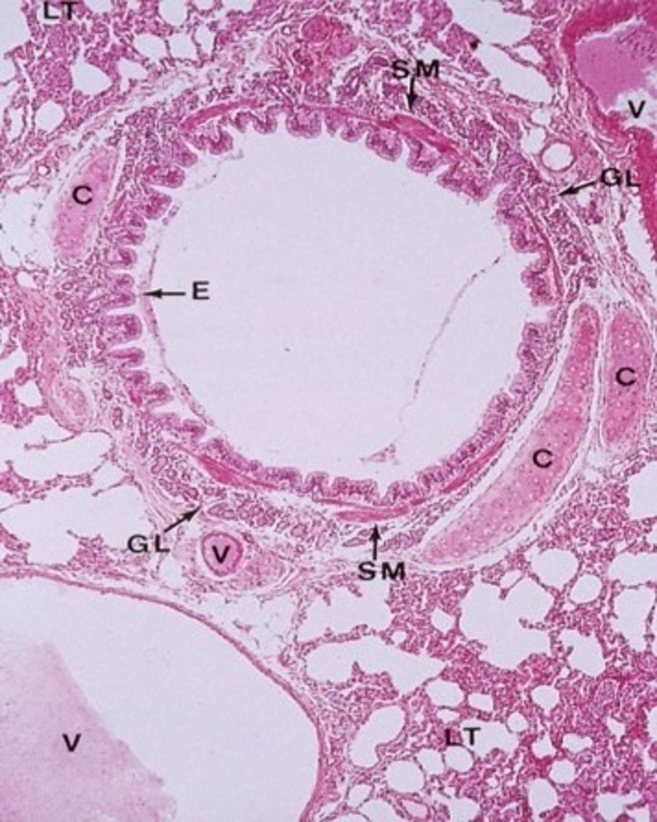 <p>small pieces - interspersed w/ smooth muscle</p>