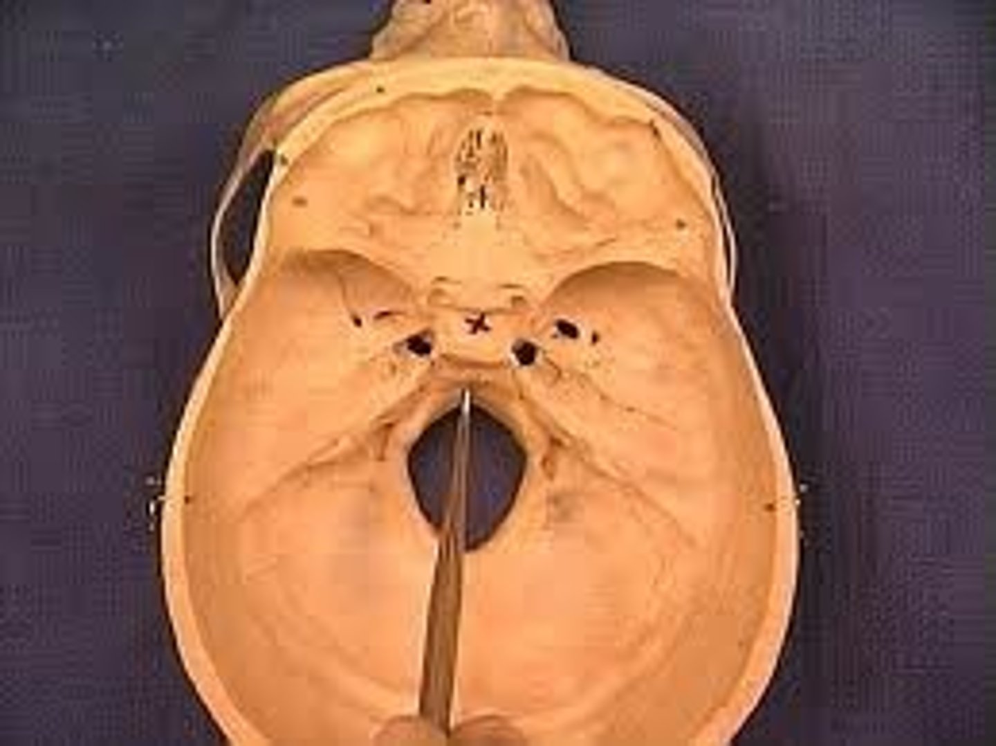 <p>- found in occipital bone</p><p>-Bony structure at the base of the skull.</p><p>-slopes down into foramen magnum</p>