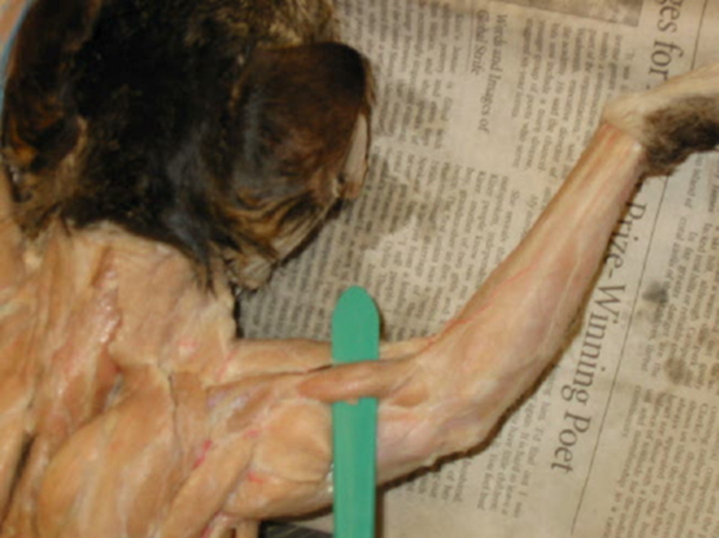 <p>Origin: humerus</p><p>Insertion: ulna</p><p>Action: flexes forearm</p>