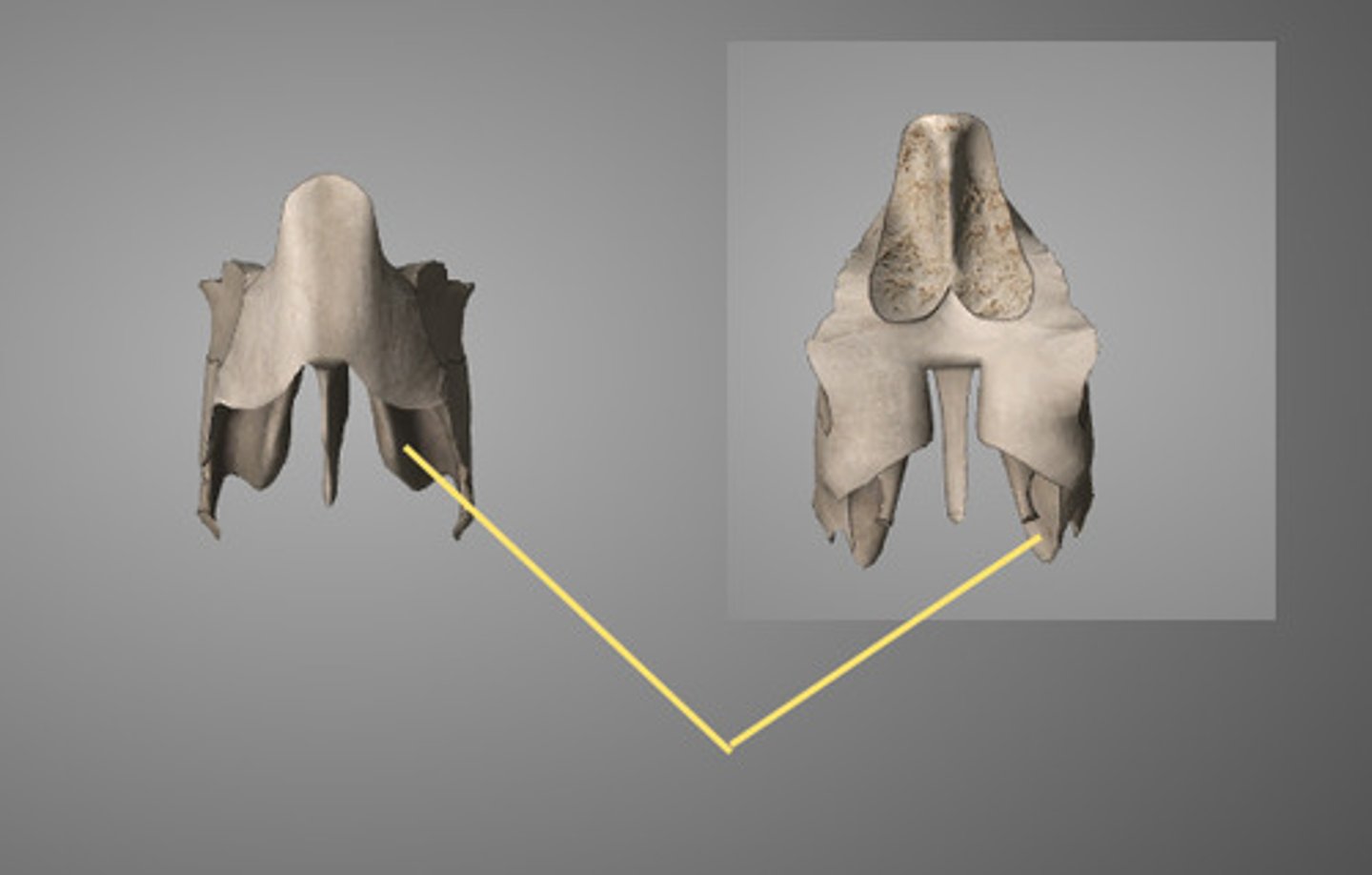 <p>structure</p><p>right and left of the perpindicular plate superior part of the sides (inside)</p>
