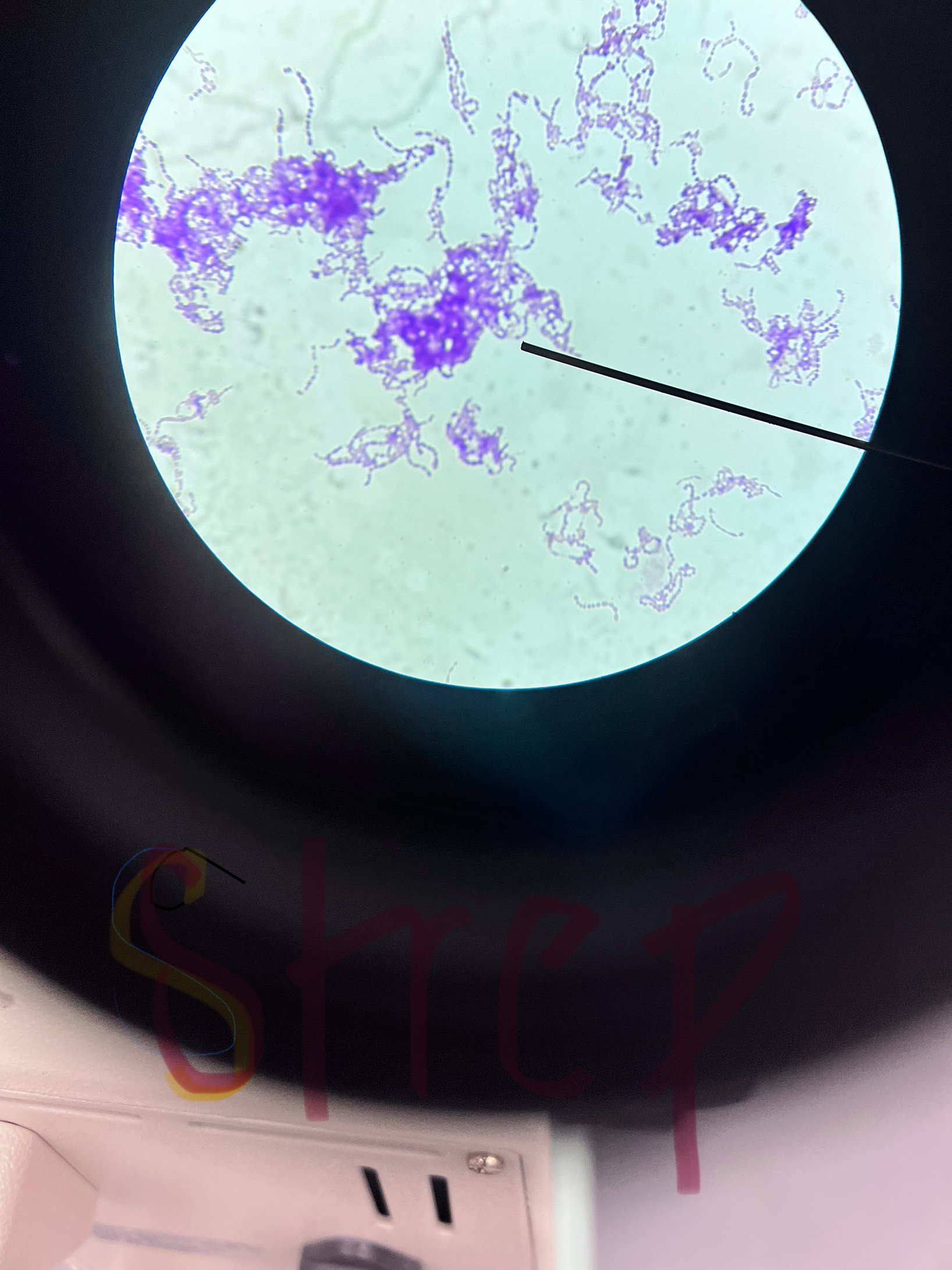<p>Streptococcus pneumoniae</p>