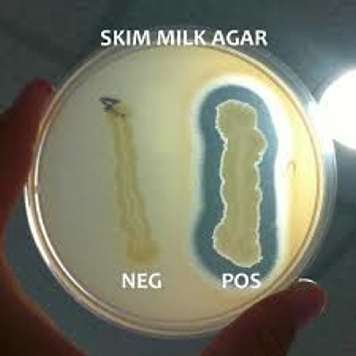 <p>Add Casein (substrate) to the media, spot inoculate Bacillus, and incubate; degradation can be directly visualized as clearing around bacterial growth.</p>