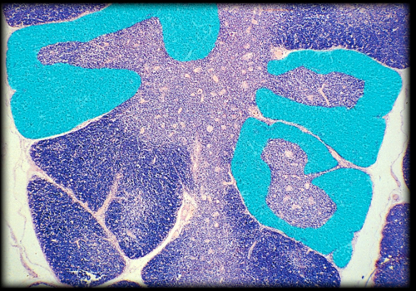 <p>Fetal thymus</p>