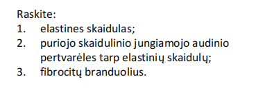 <p>Glaudusis taisyklingas skaidulinis (elastinis) jungiamasis audinys (elastinio raiščio išilginisi pjūvis)</p>