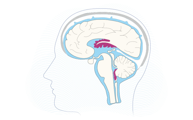 specialized structures containing ependymal cells lining blood capillaries that filter blood to produce CSF in the four ventricles of the brain