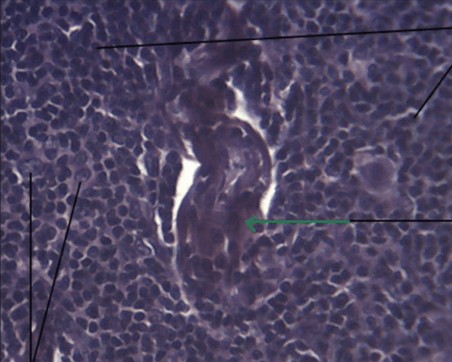 <p>gland and structure</p>