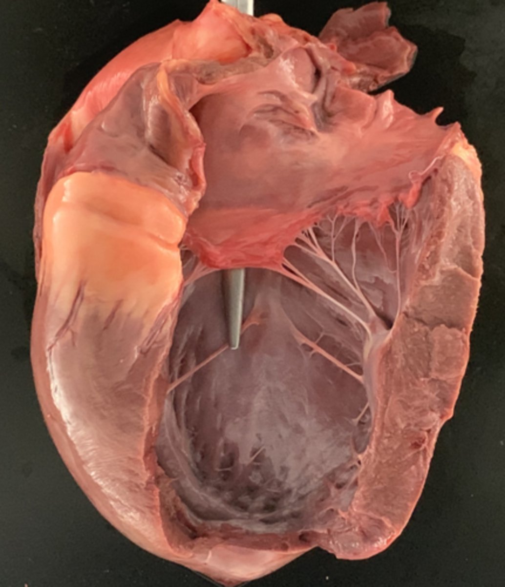 <p>Finally, the outflow to the body is the ______</p>