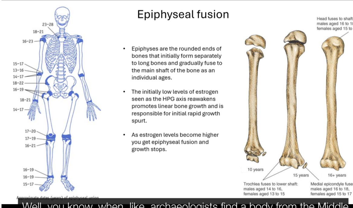 <p></p><ul><li><p>Epiphyses are the rounded ends of long bones that start separate from the shaft and fuse with age.</p></li><li><p>When puberty begins, low levels of oestrogen (from reactivation of the HPG axis) stimulate rapid linear growth (growth spurt).</p></li><li><p>As puberty progresses, rising oestrogen levels cause the growth plates to close (epiphyseal fusion).</p></li><li><p>Once fusion occurs, longitudinal bone growth stops.</p></li><li><p>Fusion happens earlier in females than males, which is why females typically stop growing sooner.</p></li></ul><p></p><ul><li><p>Early puberty:</p><ul><li><p>Adrenal androgens are noticeable (hair, acne)</p></li></ul></li></ul><p></p><ul><li><p>Later puberty:</p><ul><li><p>Gonadal steroids dominate (breasts, voice, muscle)</p></li></ul></li></ul><ul><li><p>This is shift in visible effects, not suppression of HPA activity</p></li></ul><p></p>
