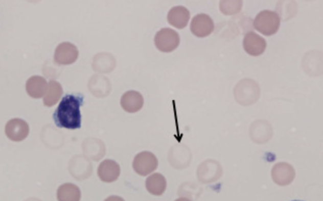 <ol start="43">
<li>What do Ghost RBCs look like?</li>
</ol>