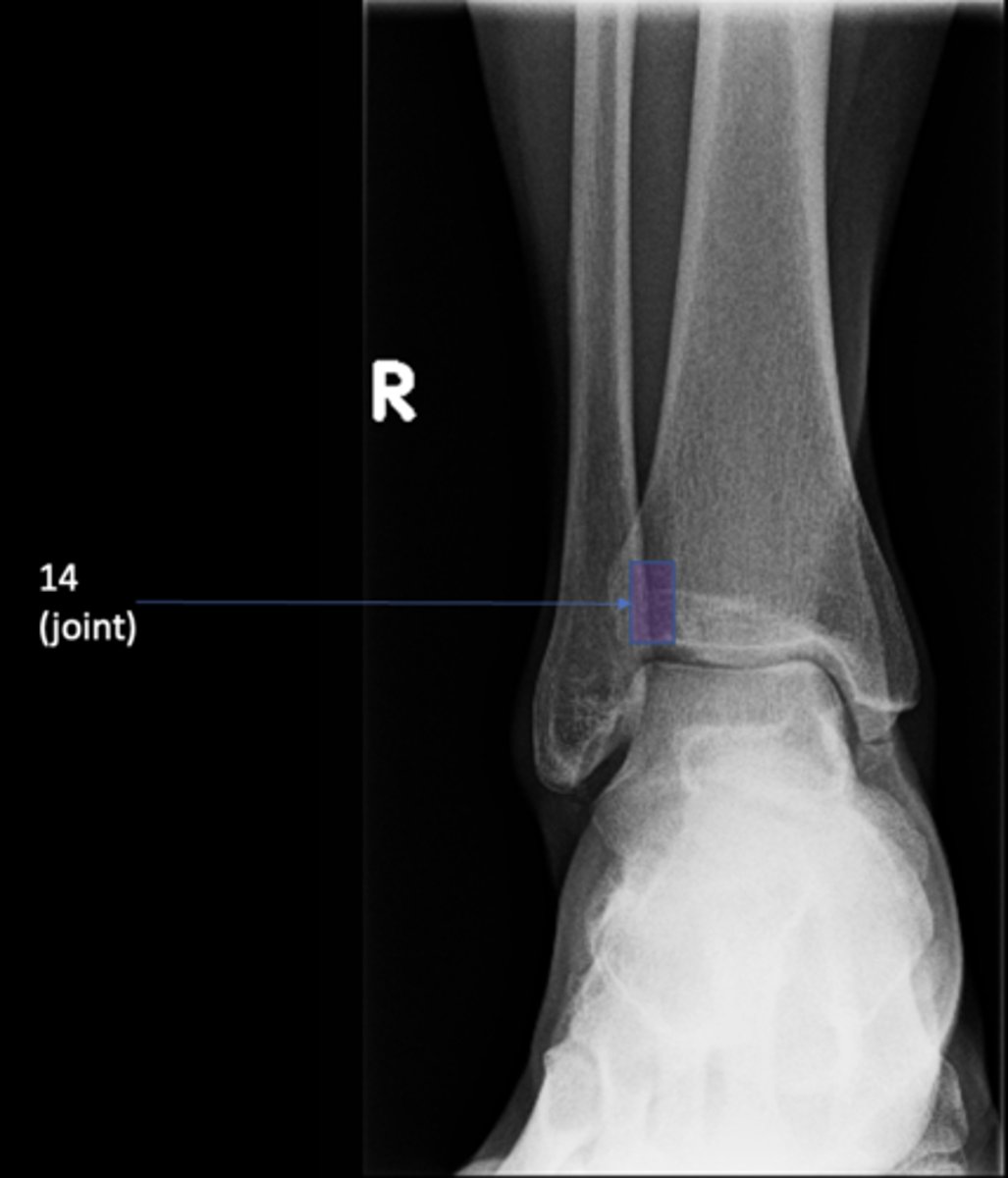 <p>ID 14 (joint)</p>