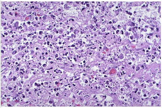 <ol><li><p>Identify the type of cell death and CD</p></li></ol><p></p>