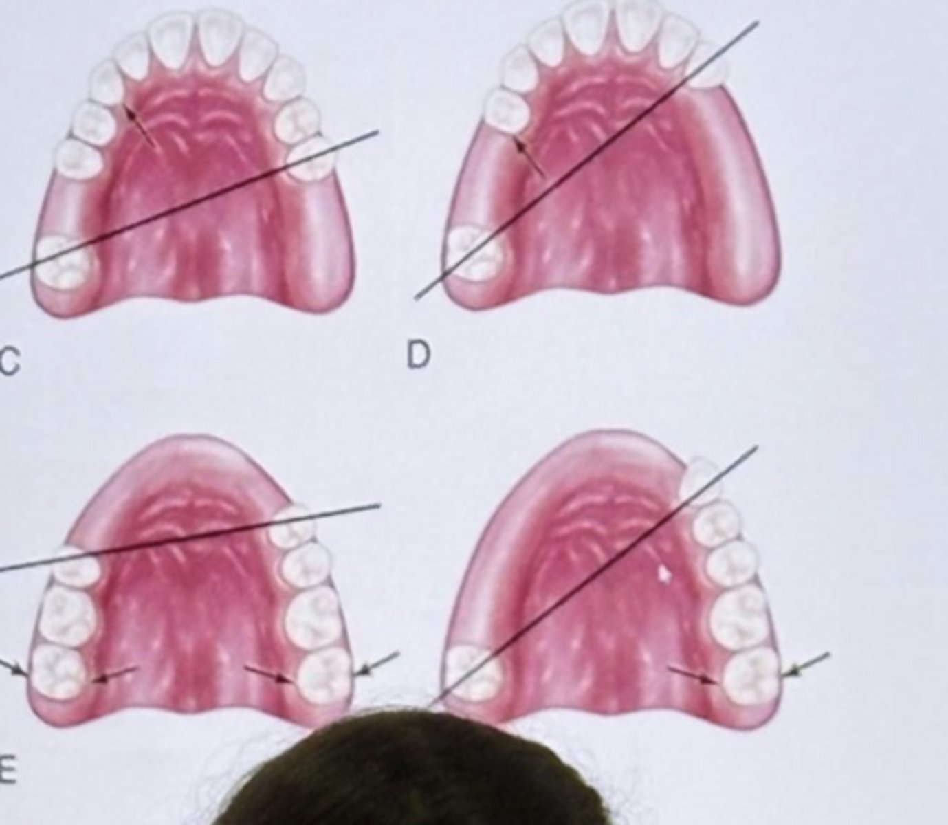 <p>C. The first statement is correct, and the second statement is incorrect</p>