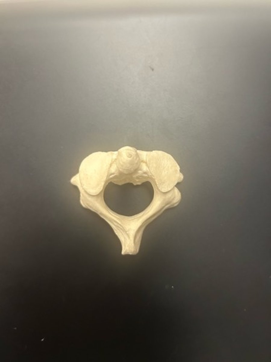 <p>name the bone</p>