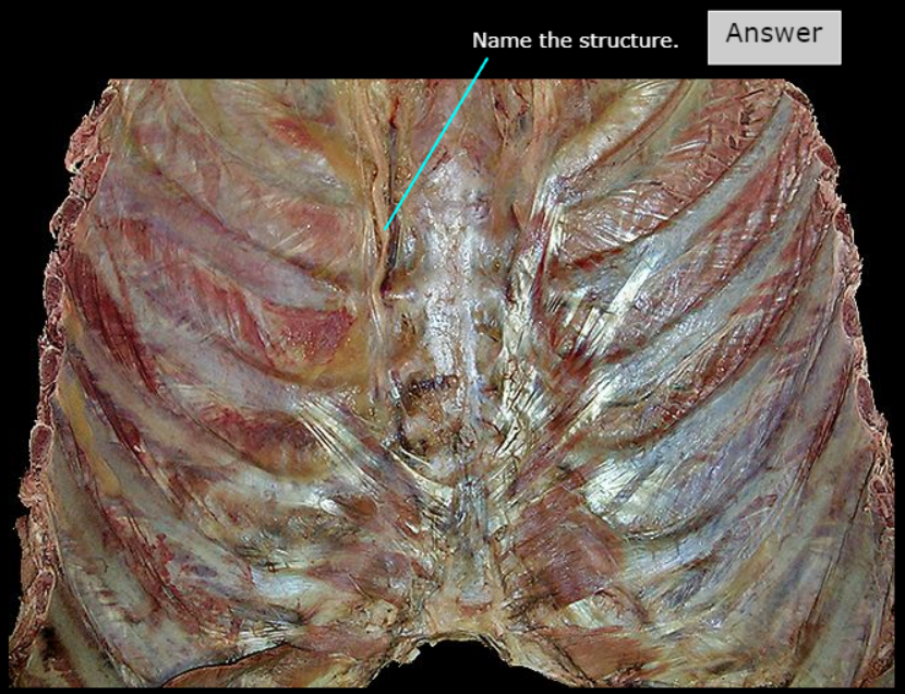 <p>What artery is this</p>