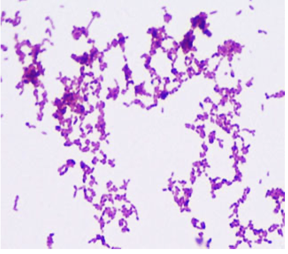 Mycobacterium smegmatics (acid fast stain)