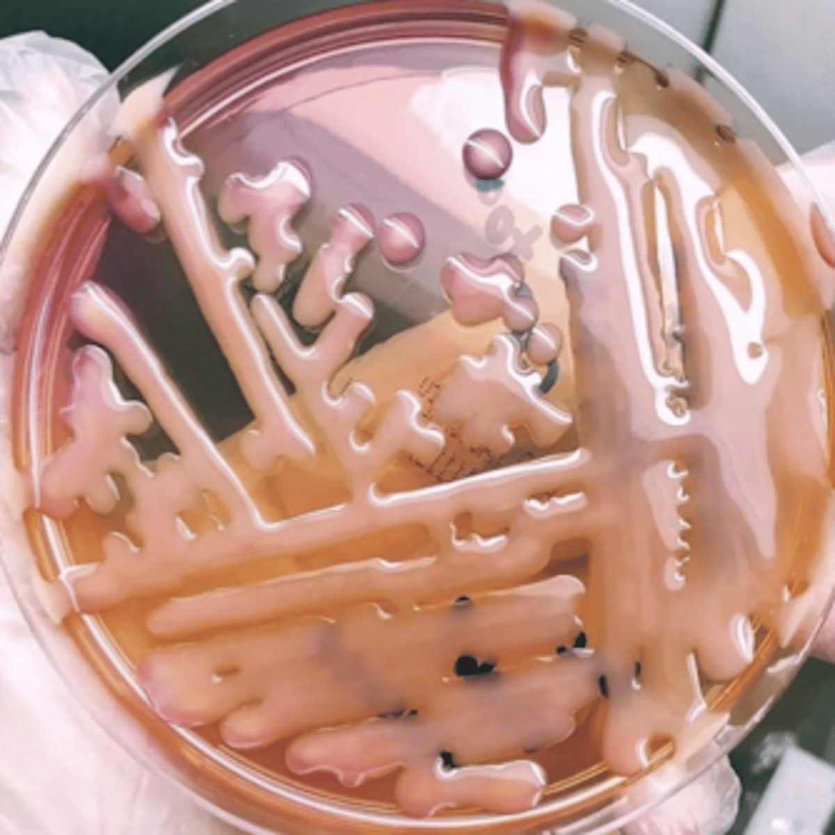 <p>what is this type of bacteria colony called that has a very thick capsule?</p>