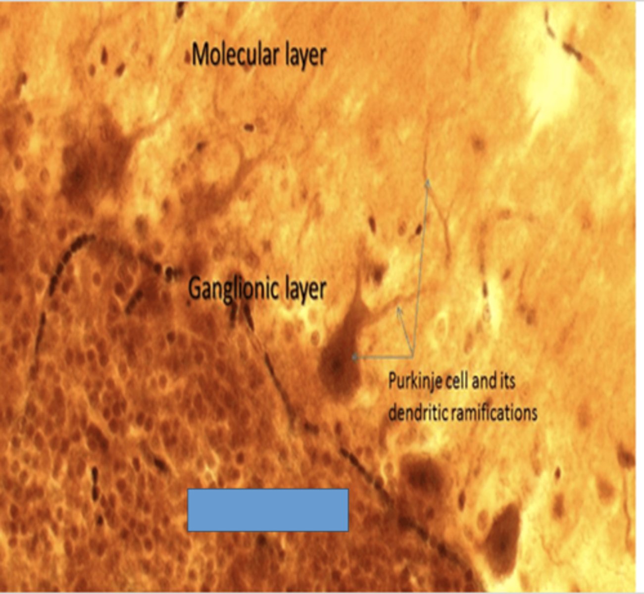 <p>Identify the layer of the cerebellum</p>