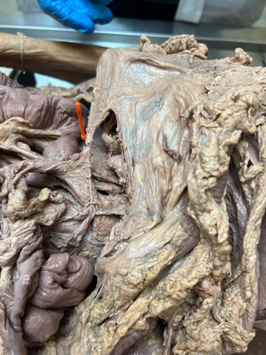 <p>inferior mesenteric artery</p>
