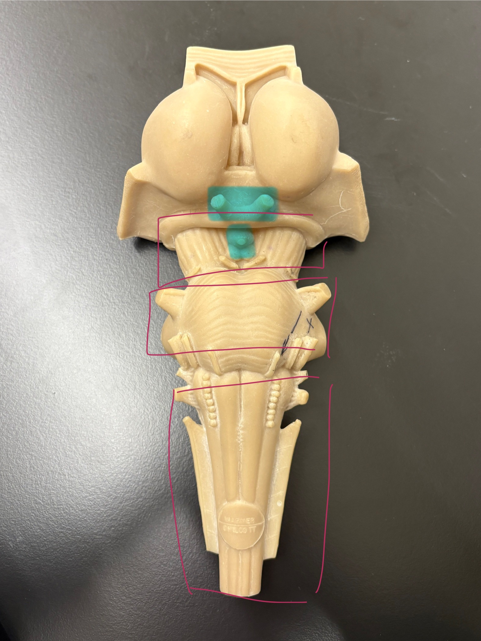 <p>Label parts of diencephalon (anterior view)</p>