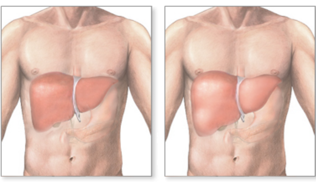 <p>Describe both images.</p>
