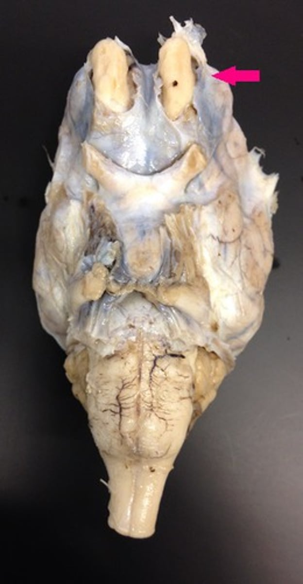 <p>Identify the covering.</p>