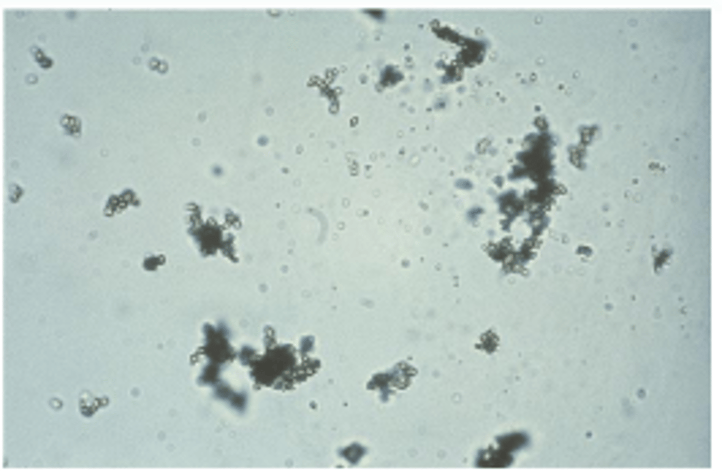 <p>-Yellow-brown granules microscopically<br>-Pink sediment due to pigment uroerythrin<br>-pH greater than 5.5</p>