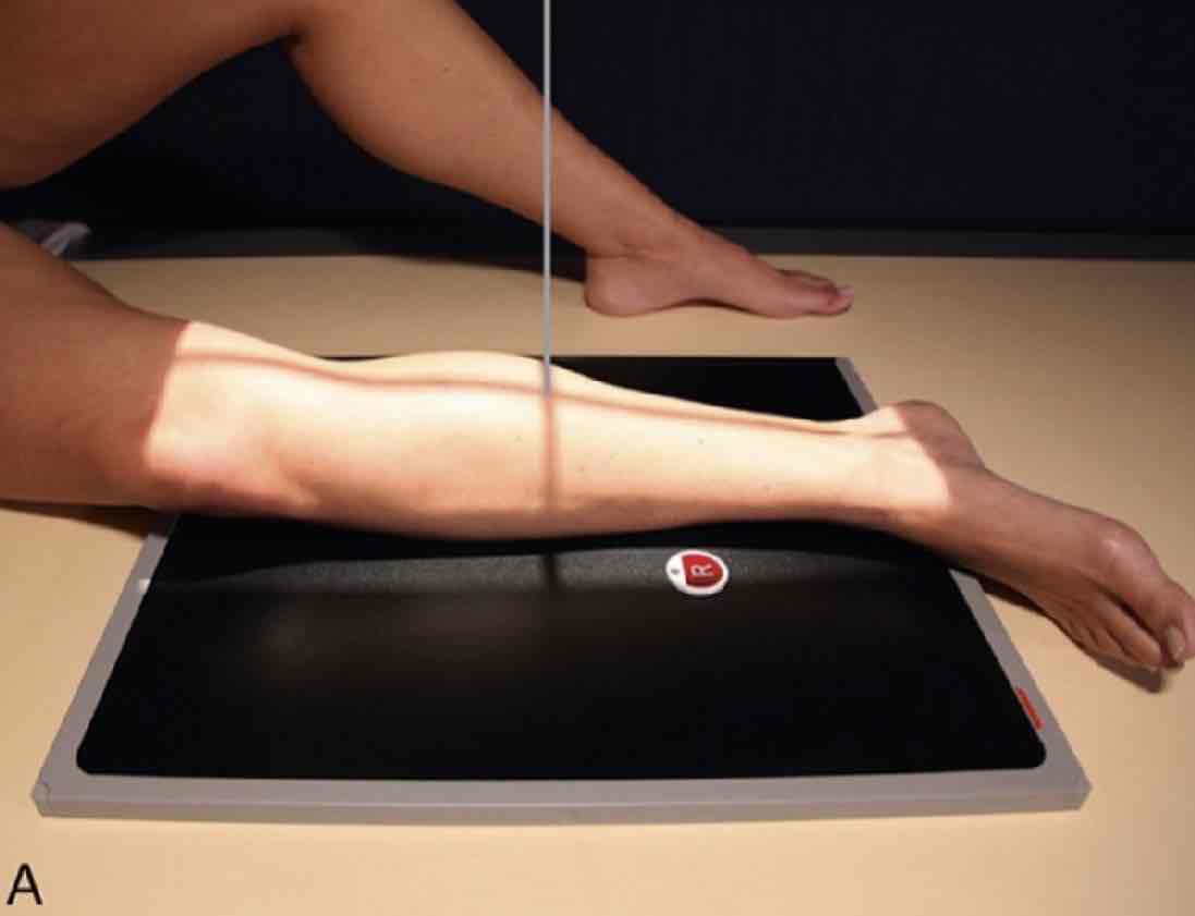 <p>What Projection is this?</p>