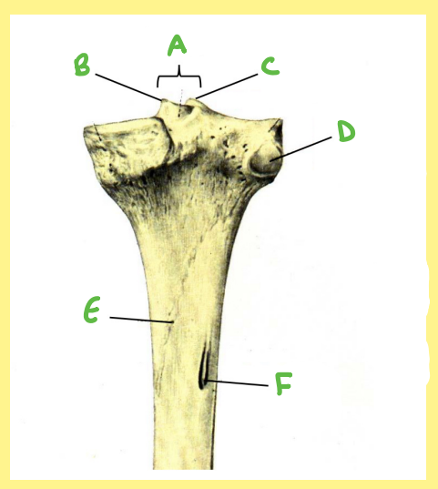 <p><u>Name the following</u>:</p><ul><li><p>Bone?</p></li><li><p>Side?</p></li><li><p>View?</p></li><li><p>F?</p></li></ul><p></p>