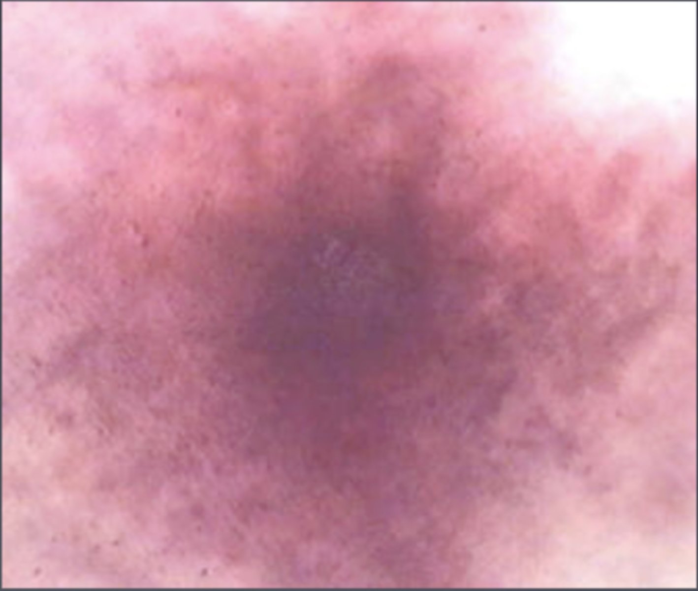 <p>-Detects lead</p><p>-Results in bright pink</p><p>-Done directly on the surface</p>