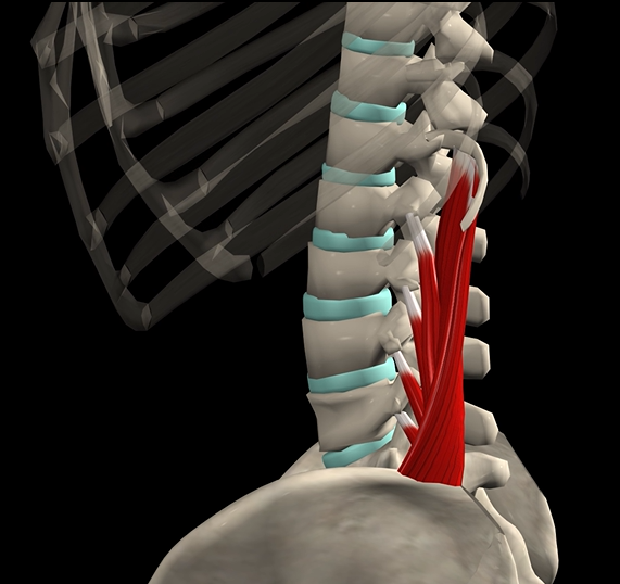 <p>Function: extension of spine</p><p>Origin: iliac crest</p><p>Insertion: lumbar vertebrae</p>