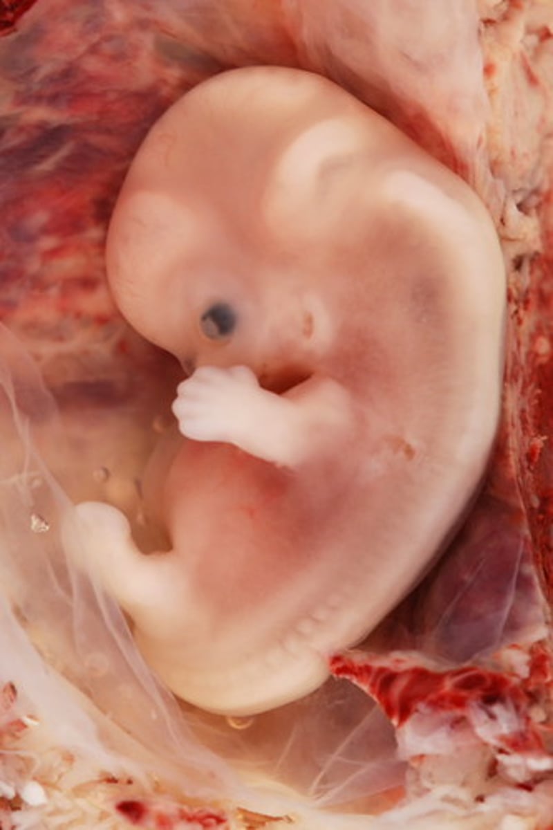 <p>Stage of first 0-8 weeks of pregnancy</p>