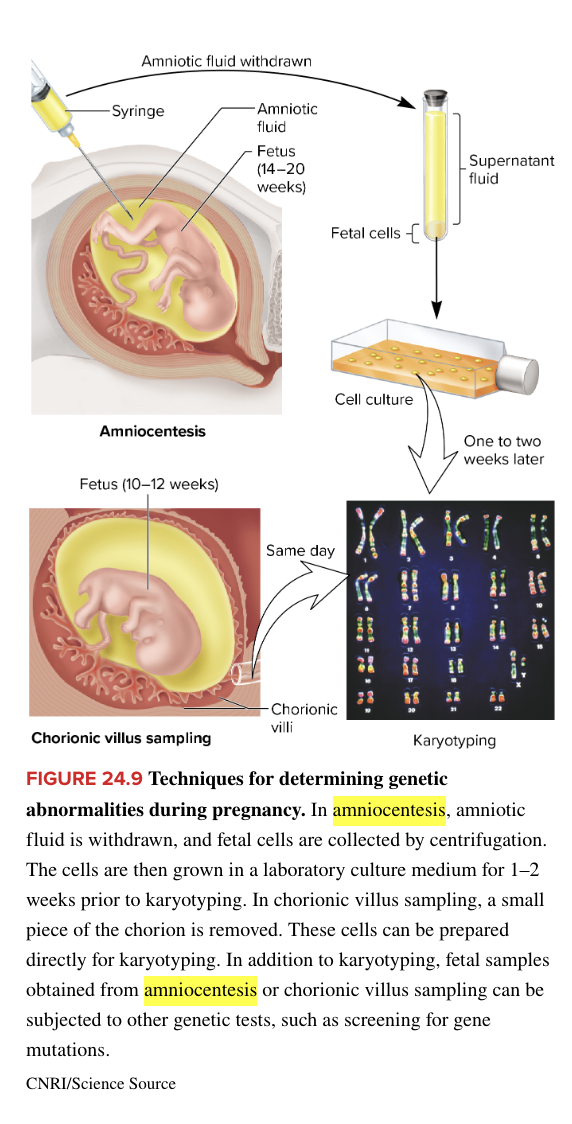 <ul><li><p>conducted before pregnancy even occurs</p></li><li><p>genetic testing of embryos hat have been produced by IVF</p><ul><li><p>IVF combines sperm + egg outside mom’s body</p></li><li><p>1 or 2 cells removed at 8 cell stage</p></li><li><p>tests conducted to check for problems</p><ul><li><p>molecular tests can check for particular gene defects</p></li><li><p>chromosome composition can be checked</p></li></ul></li><li><p>decision made whether or not to implant</p></li></ul></li><li><p>raises ethical q’s</p></li><li><p>method of genetic testing prior to birth</p></li></ul><p></p>