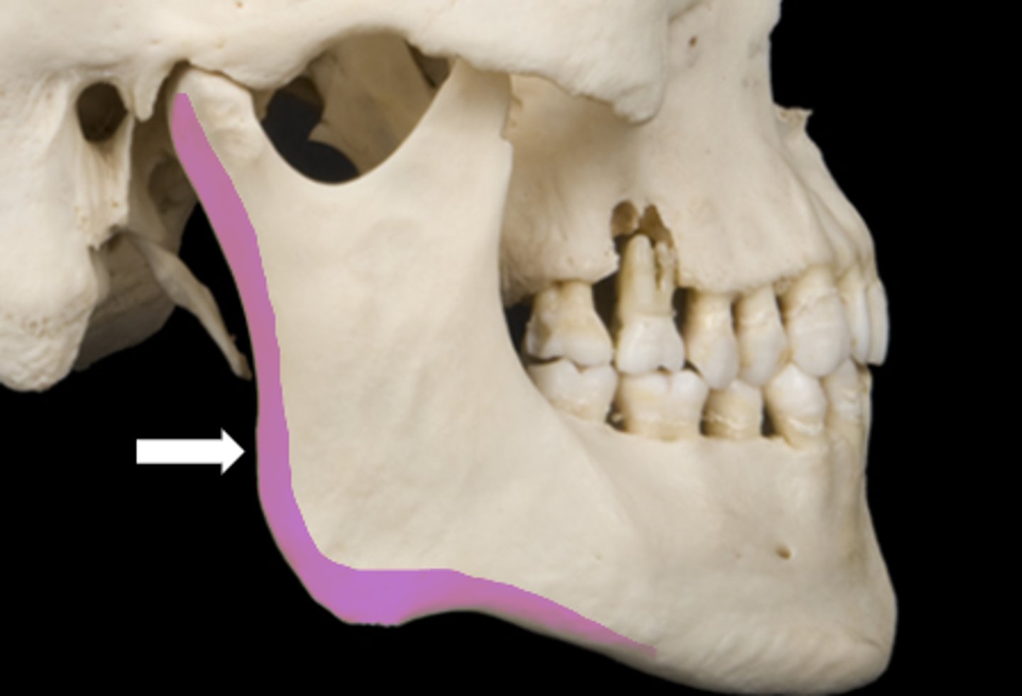 <p>name the part</p>