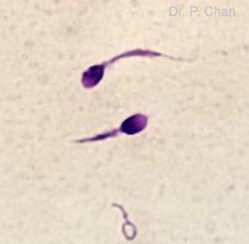 <p>Identify the sperm morphology.</p>