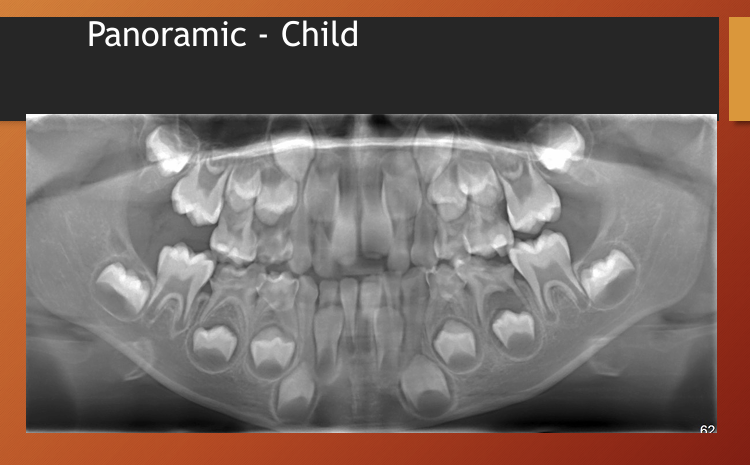<p>child</p>