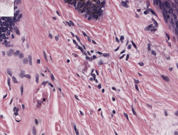 <p>Fibroblasto y fibrocitos</p>